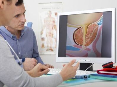 A urologist consults a patient on problems with potency